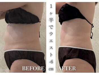 リアレント 高槻店(Lialent)/インディバ60分×6回【60代】