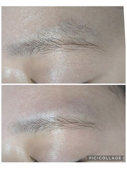 マロウド(malowdo)/眉毛脱毛/片眉15分