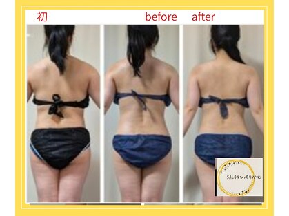 ひぺりかむの写真