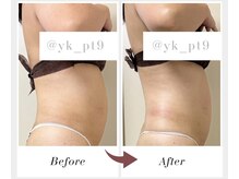 ノヴェル(Novelle)の雰囲気(即実感!気になるお腹も1回でここまで変わる!ボディライン形成♪)