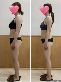 エステシオン(ESTESiON)/2か月