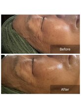 エワル 半田店(ewalu)/お客様BeforeAfter♪