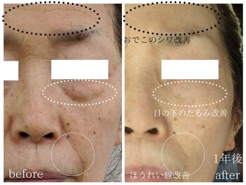 ラミーユ(La Miu)/オーダーメイドセラピーPALUPALU