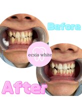 エクシア ニイガタ(ecxia niigata)/ビフォーアフター　新潟万代