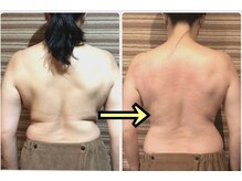 メル/【神痩せ】痩身結果