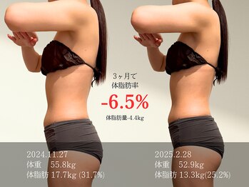 マルノウチ サロン(MARUNOUCHI salon)/施術5回ビフォーアフター