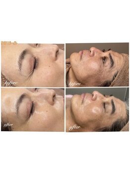 銀座ナチュラルスタイル/眼精疲労/骨盤矯正/