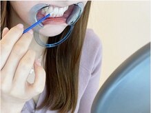 エクシアホワイトニング 碧南店/5.　歯に溶剤（ジェル）を塗る