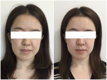 美容整体 ウェリナ 蟹江院/小顔矯正/骨盤矯正/美脚サロン 