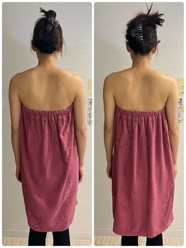 ロココ 豊田店(Rococo)/ビフォーアフター