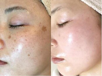 ファニービー 高槻店/Before→After