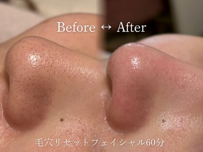 セレソル(CERESOL)の写真