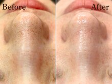 ルーミー 南青山(LUME)