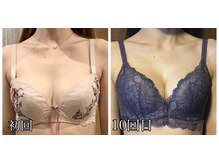 リルマコ/バスト症例写真