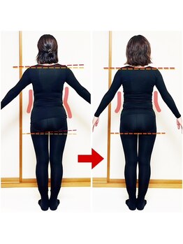 オステオデイジー(OsteoDaisy)/姿勢と体型