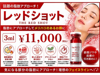 ジーン(Gene)の写真