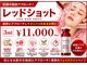 ジーン(Gene)の写真