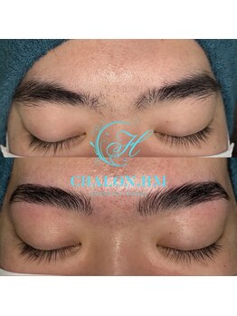 シャロンドットエイチエム(CHALON.HM)/アイブロウリフト