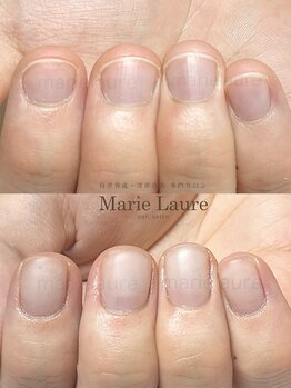 マリーロール 淀屋橋本店(Marie Laure)/自爪育成/深爪矯正/ネイルケア