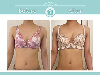 美人バスト 表参道店/【バストアップ/育乳☆症例】