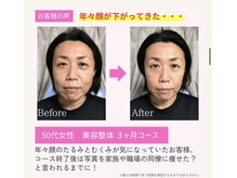 えのもと美容整体院/顔の歪み、むくみ、たるみ改善