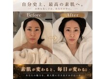 メナードフェイシャルサロン 宮の沢の雰囲気(1度のエステで効果◎回数を重ねることで肌質改善)