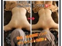 強め筋膜痩身リンパ 小顔エステBAR北野/