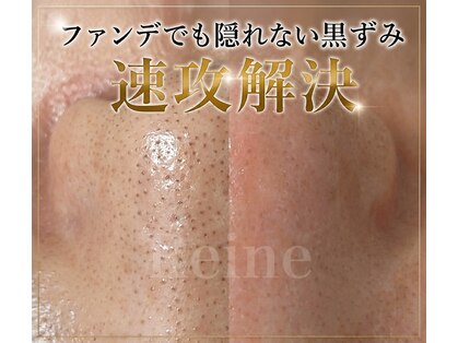 レーヌ(Reine)の写真