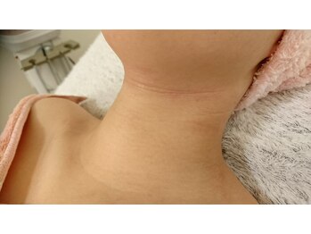 サロンエム(Salon m)/【過敏肌、ATP肌】