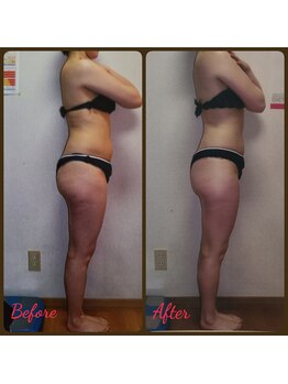 ダイエットルーム リ ボーヌ(Re Bornu)/・30代 全身メディセル8回