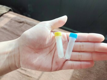 トータルビューティーアリエス(Aries)/最高級ヒト幹細胞