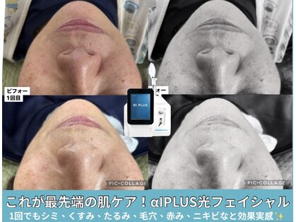 リバイブ(REVIVE)の写真