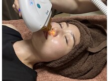 ソレラ(sorelle)/鼻の穴周り脱毛