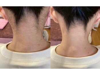 ティンク(Tink)/うなじワックス☆Before→After