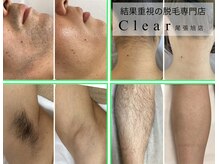 クリア 尾張旭店(Clear)