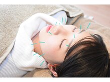 カリーナ(Carina)/美容鍼