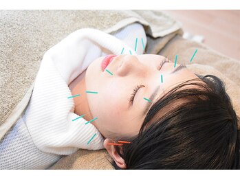 カリーナ(Carina)/美容鍼