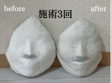 コルギサロン 伏見店(k_korugi.salon)/食いしばり改善にコルギ◎◎