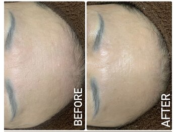 リセラージュ(Recellage)/グロッティ★ヒトサイタイ導入