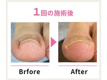 名古屋駅前巻き爪センター