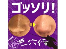 アミューアネイル(imuya nail)の雰囲気（当店大人気メニューの毛穴洗浄です♪）