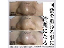 ヴィモアビューティーサロン(Vimore Beauty Salon)の雰囲気（毛穴エクストラクションプロ・ラボーテ式認定サロンです。）