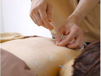 やの鍼灸治療院/効果◎体の仕組みを熟知した施術