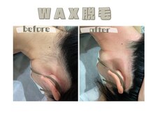 レヴィート(Revept)/【ワックス脱毛】