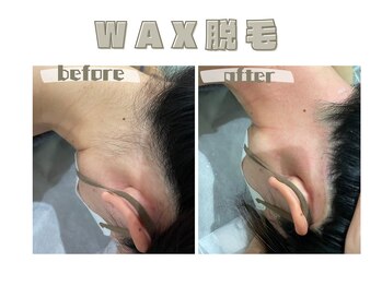 レヴィート(Revept)/【ワックス脱毛】