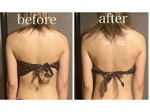 イーストモア(EAST MOIS)/背中側からバストアップ