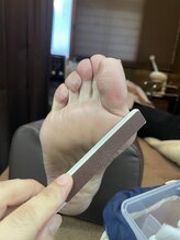 ビー ハウス(B- House)/角質取り