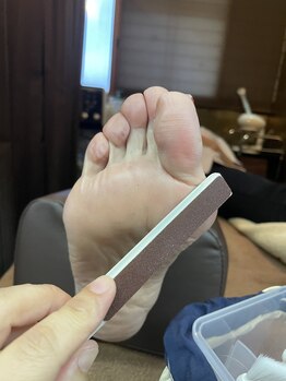 ビー ハウス(B- House)/角質取り