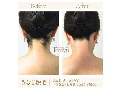 エミュー(Emyu)の写真