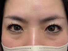 エイジレス(AGELESS)/